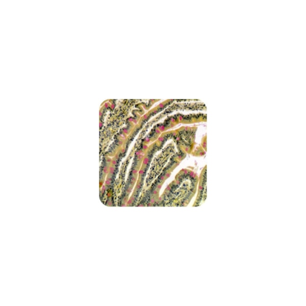 Mucicarmine Stain Kit